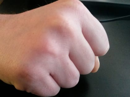 Стали известны новые подробности инцидента с подростком, которого ударил водитель маршрутки