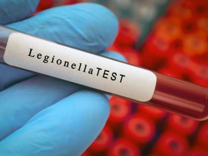 Смертельно опасная болезнь легионеров, может прийти в Россию: при чем тут центральное кондиционирование