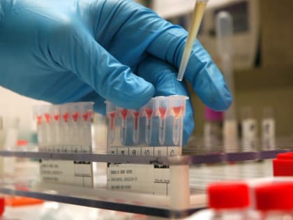 В Мордовии суммарная заболеваемость острыми кишечными инфекциями за полугодие выросла на 36,2%