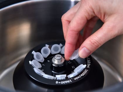 Наши ученые нашли способ удешевления лазерной онкотерапии