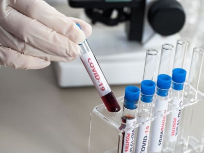 Мордовия впервые за долгое время прожила день без коронавируса