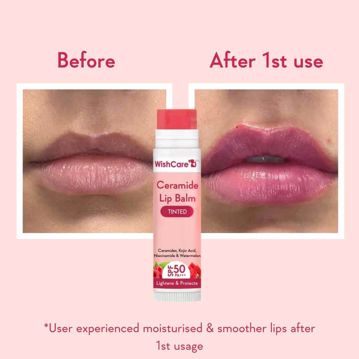 WishCare Ceramide Lip Balm vanijay3