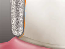 849 G FG 016 instrument diamanté img