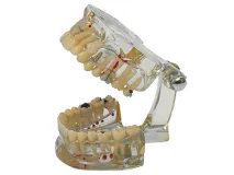Modèle d´étude Transparent Plus img