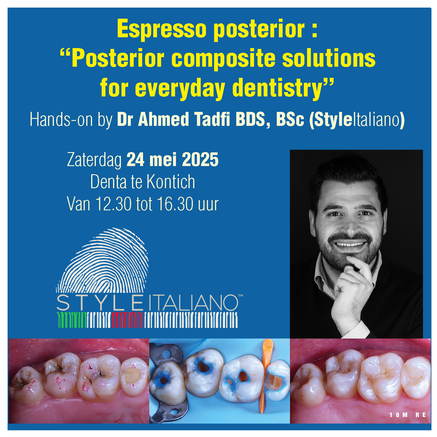  Afspraak Radiologie Halle  thumbnail