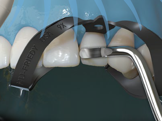 Akro-flex Instrument - denta.be