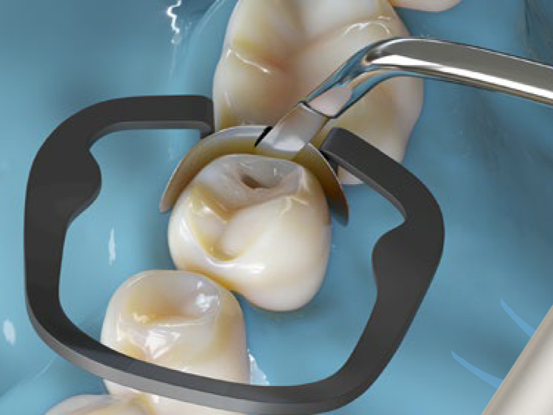 Akro-flex Instrument - denta.be