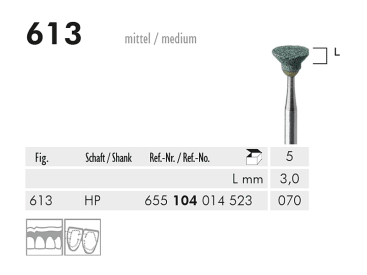 Pointes de polissage dentaire 613 HP abrasif (green, medium) img