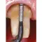 Satelec insert PM2 A29753 img