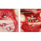 ME Micro Screw System P A49441 img