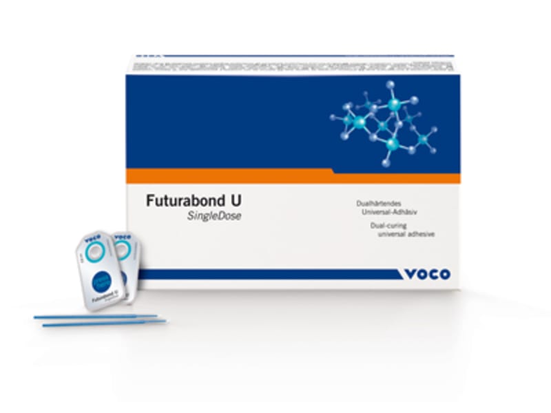 Voco Futurabond U SingleDose trial 1x20 1574 A37672 img