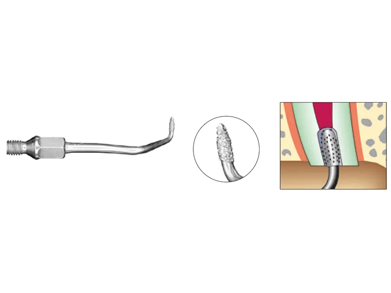 Kavo SONICflex retro insert nr.17A A45902 img