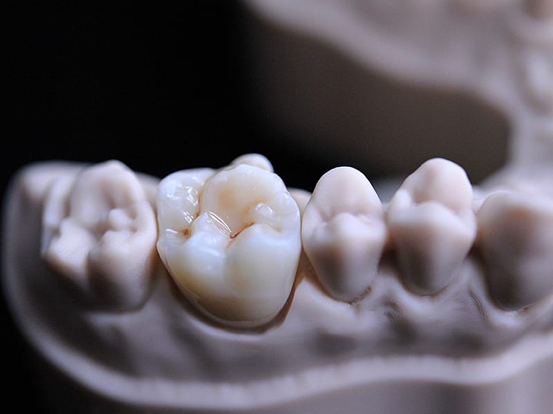 Saremco print CROWNTEC 500g 2055 img