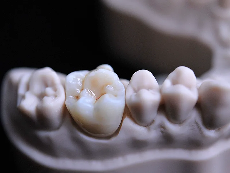 Saremco print CROWNTEC 500g 2055 img