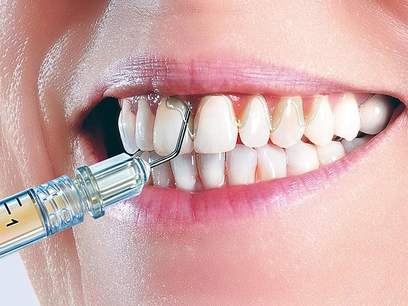 HF Sterify Gel spuit 1x0,3ml A50683 img