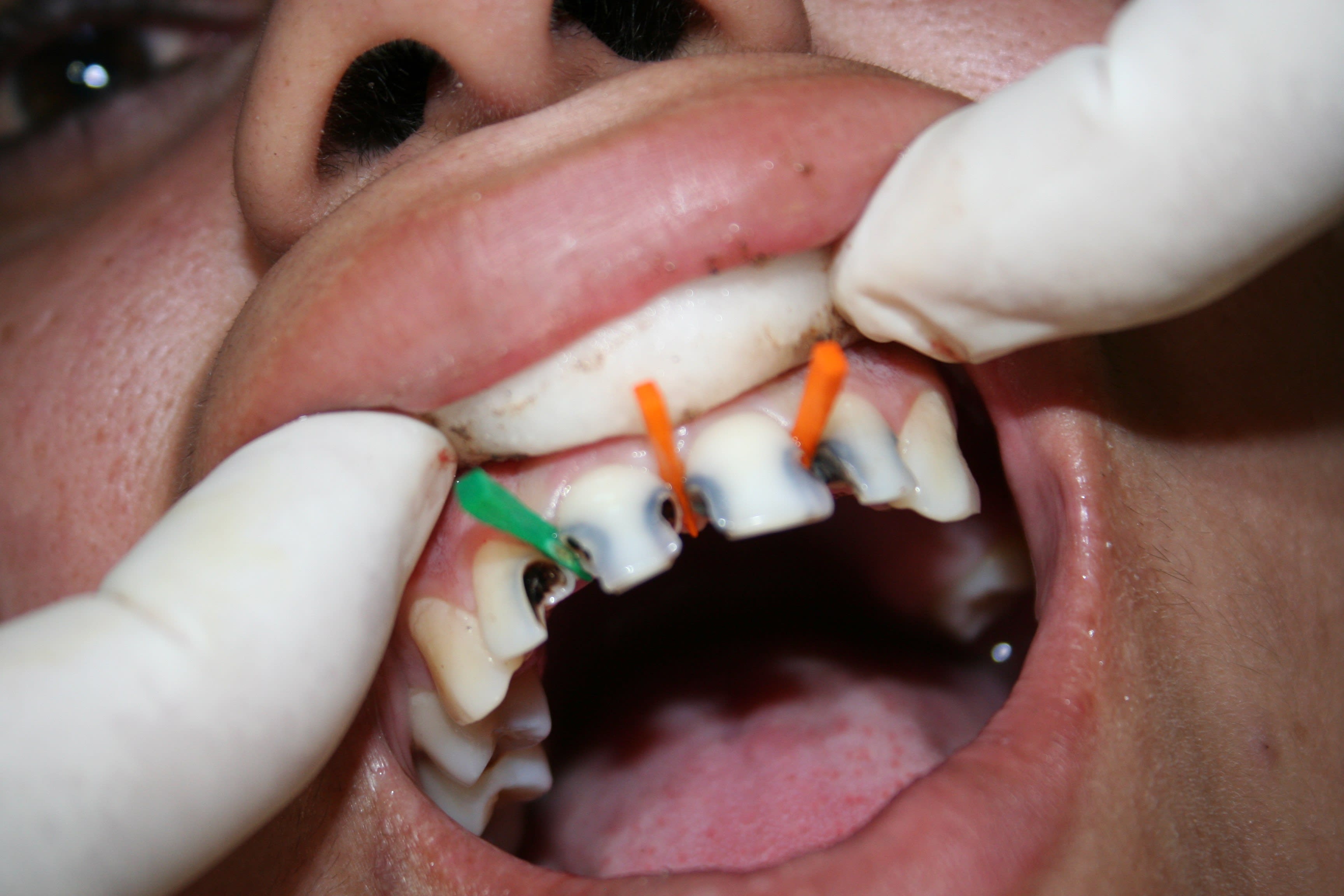 Dr Jim Thomas works his magic