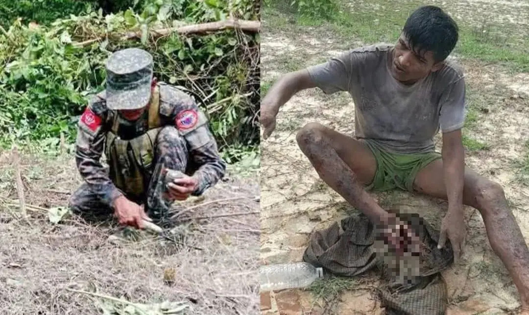 Rohingya youth injured in landmine blast near Myanmar border