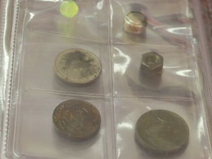 Подмосковные медики вытащили необычный предмет из желудка подростка