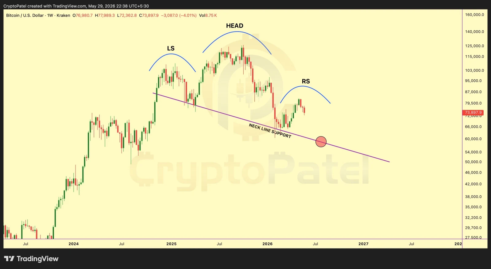 Bitcoin Price analysis