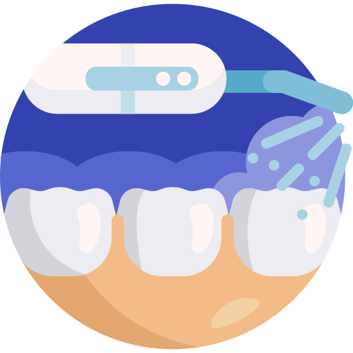 Perawatan Periodonti / Jaringan Lunak