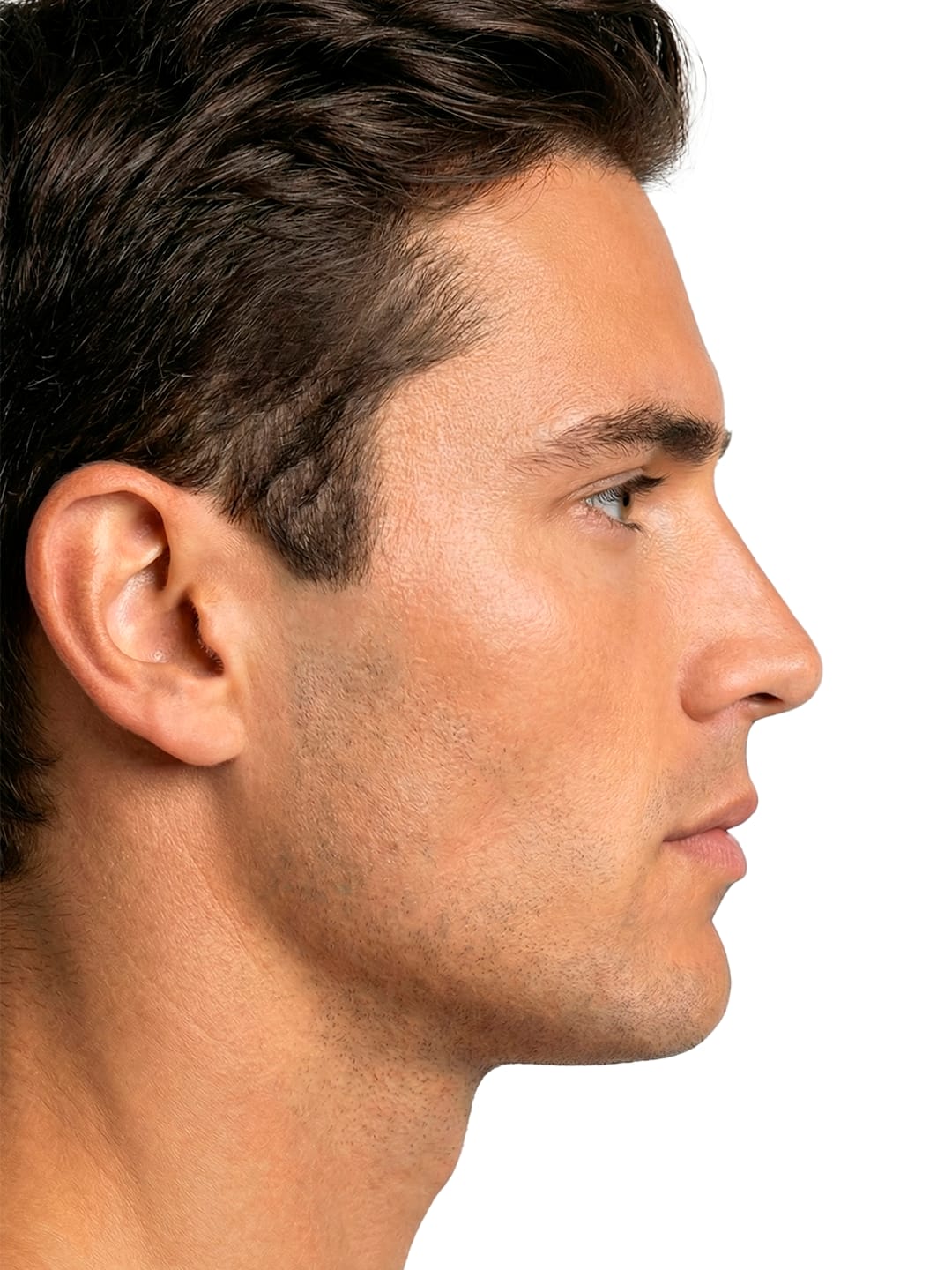 Depilación Láser Patillas sin delimitar