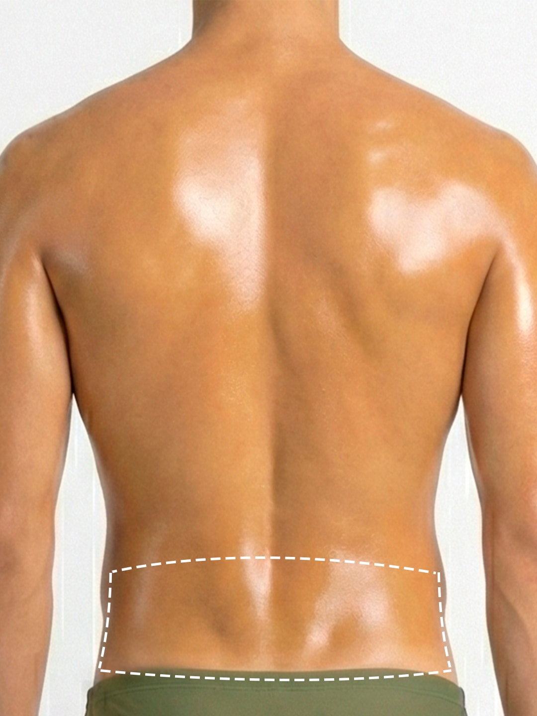 Depilación Láser Lumbar delimitada