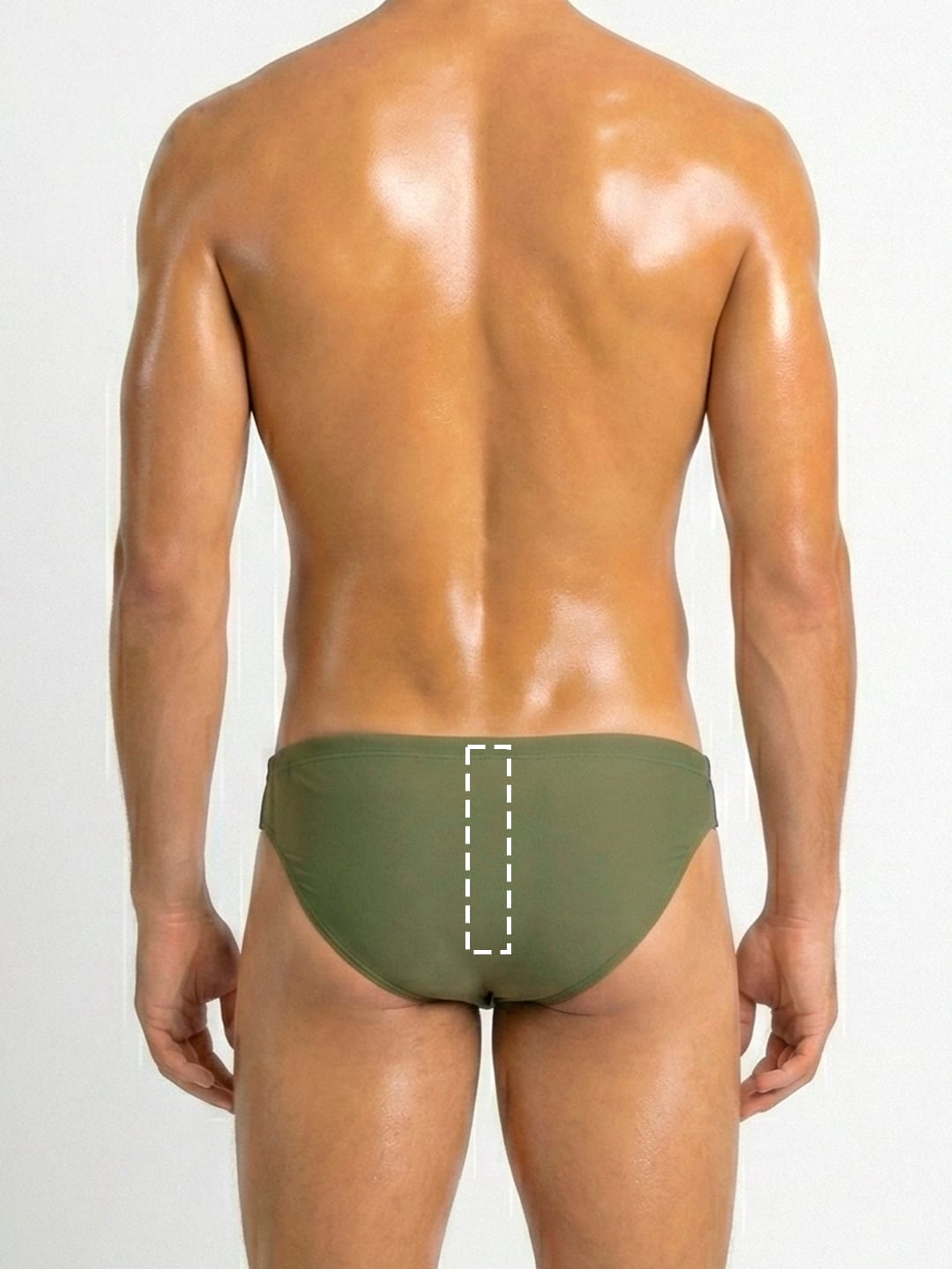 Depilación Láser Perianal delimitada