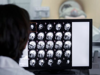 Связь между травмами головы и послеродовыми расстройствами у женщин