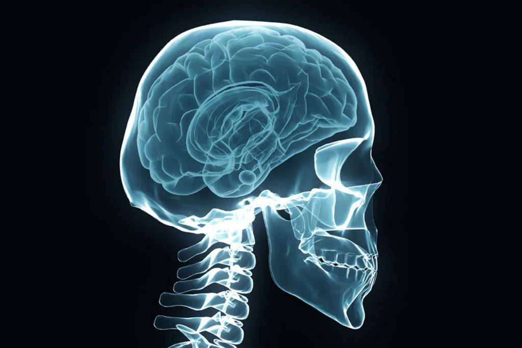 TRAUMATIC BRAIN INJURY LAW