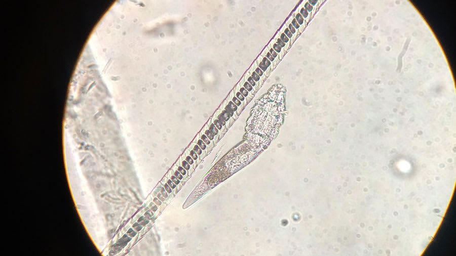 Microscopic view of Demodex mite
