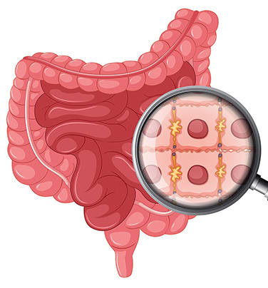 gut-img