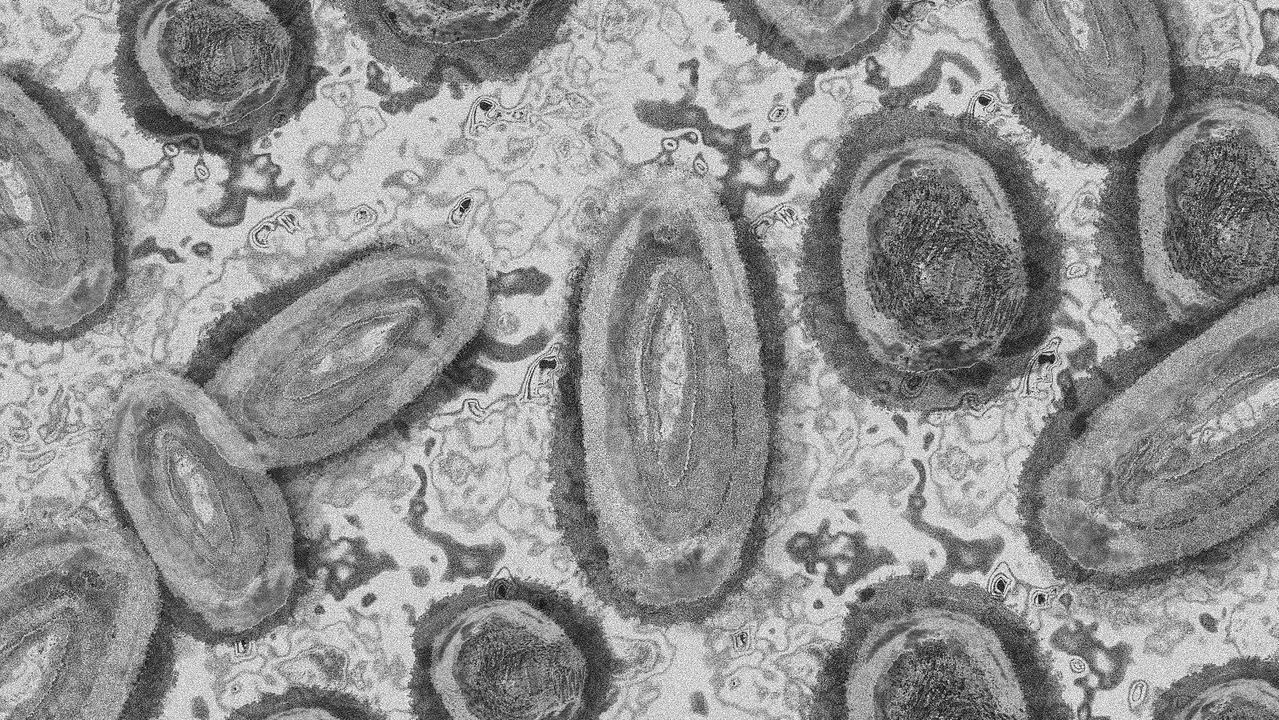 Microscope view of Monkey Pox virus