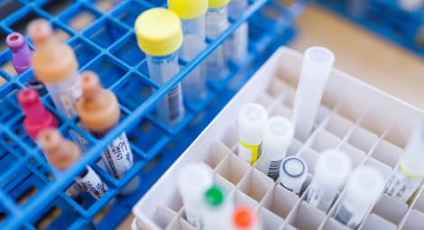 Plastic organizers in a laboratory filled with tubes and samples