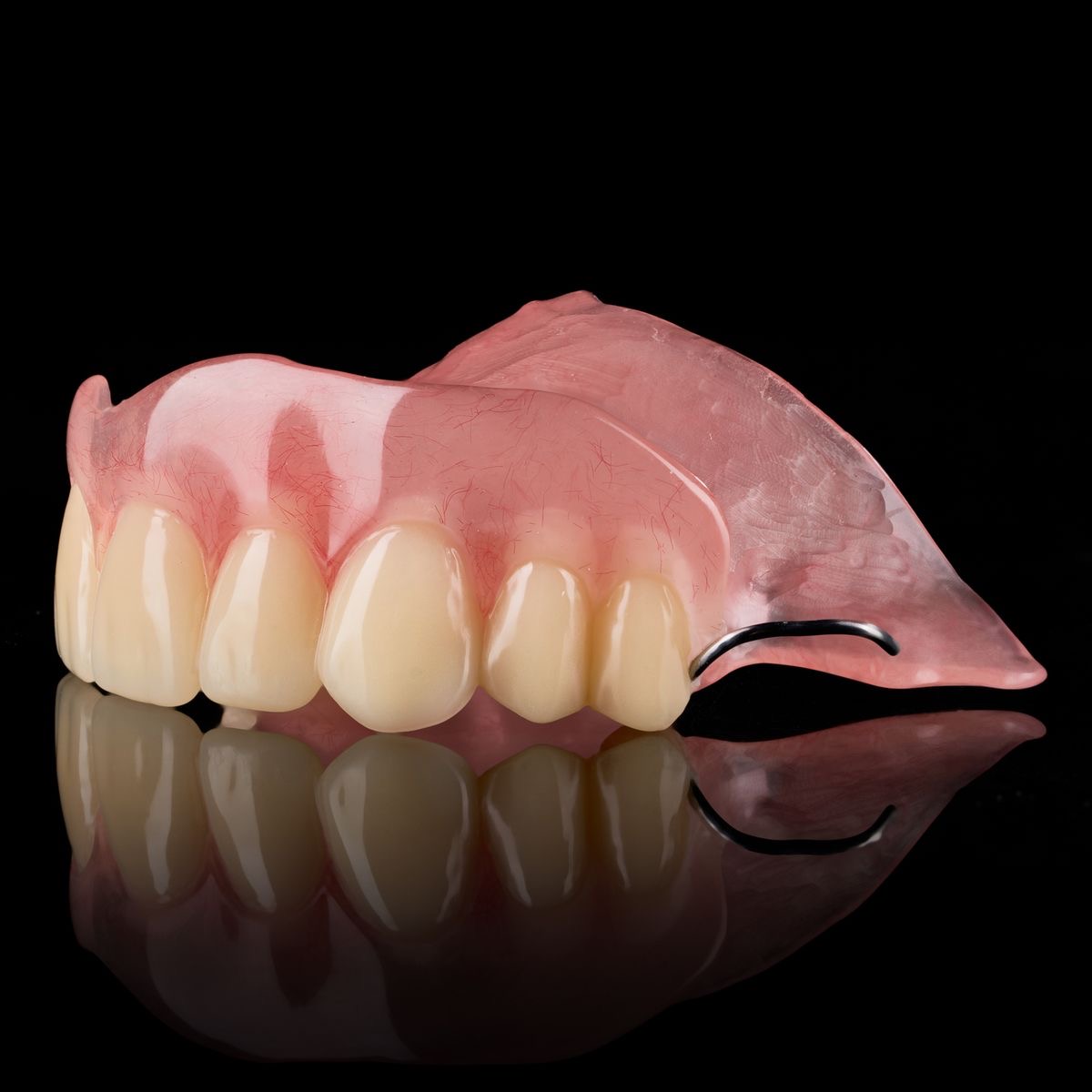 Bali Dental Assistance - Partial Denture