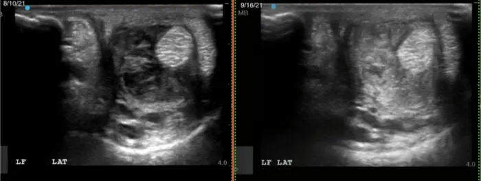 Ultrasound 2