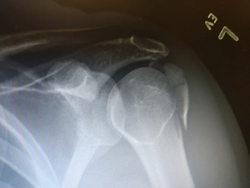 BrinkLaurenNetheryxray