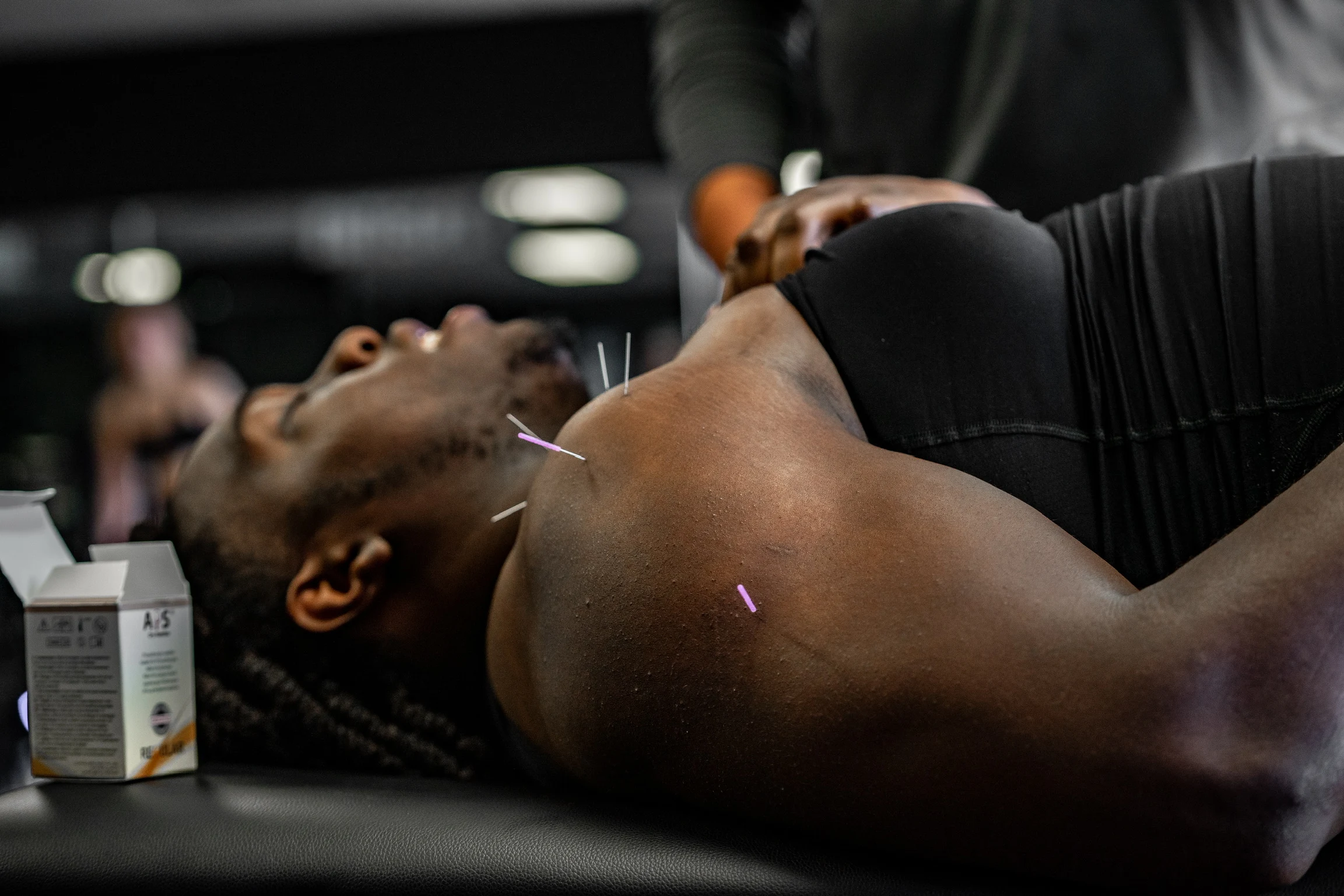 dry-needling