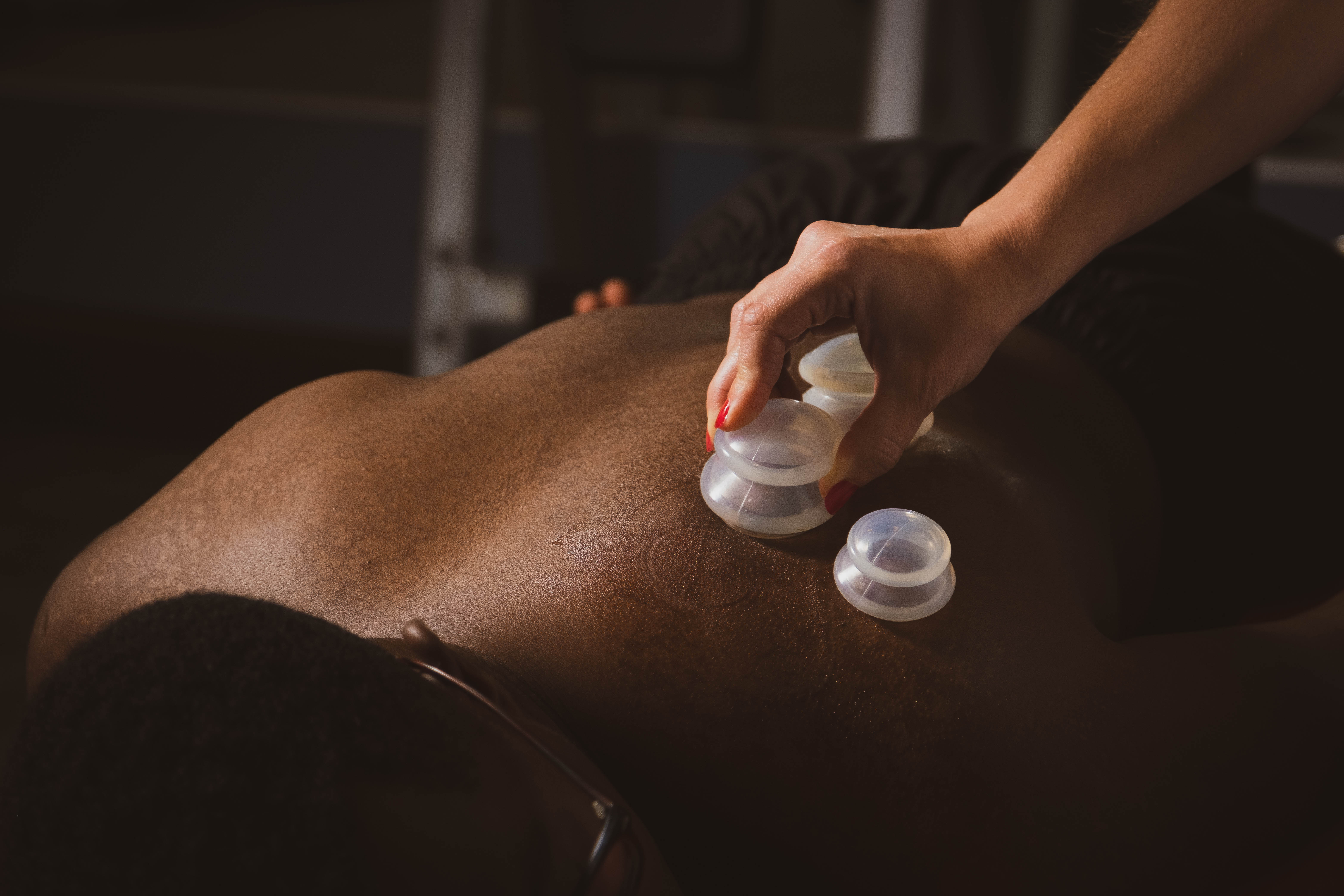 cupping