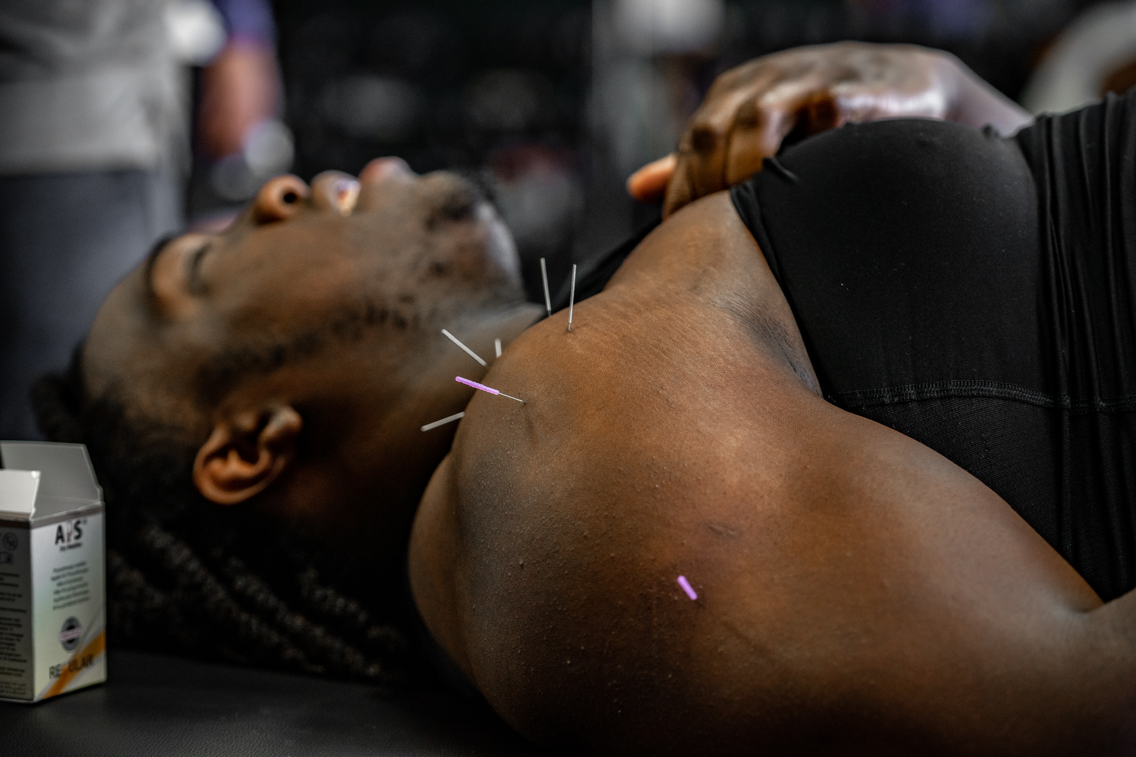 dry-needling