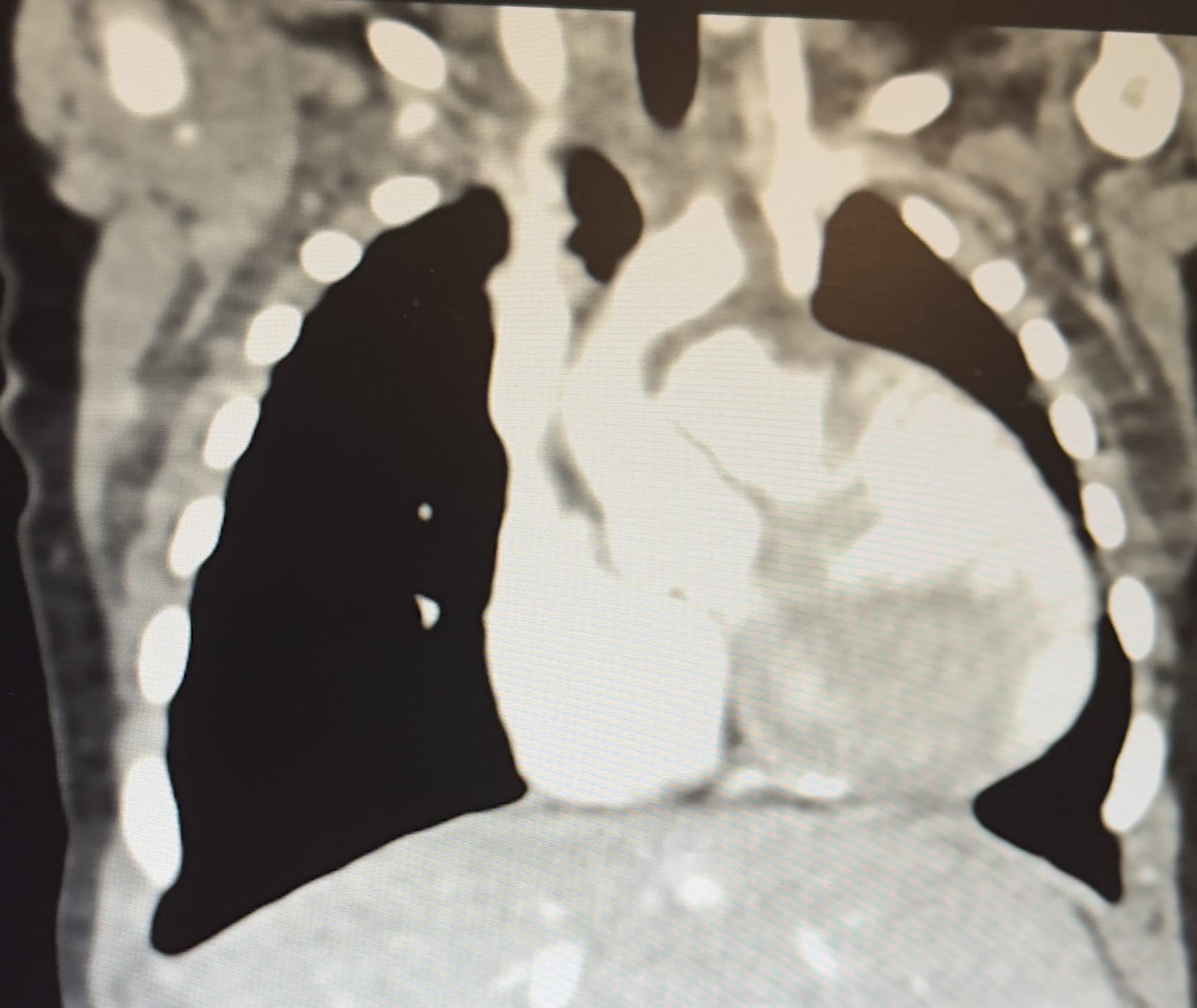 Image from 08/31/2024 Update