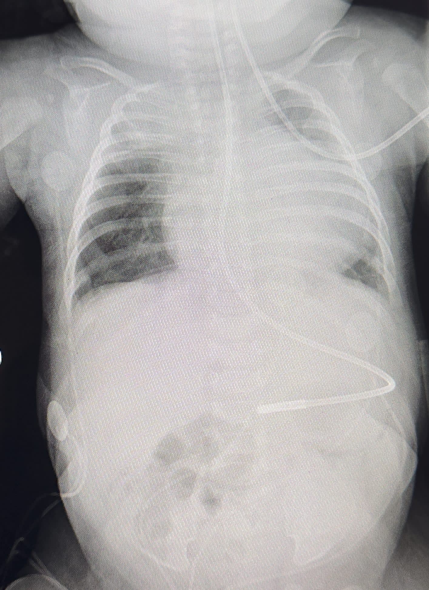 Image from 08/31/2024 Update