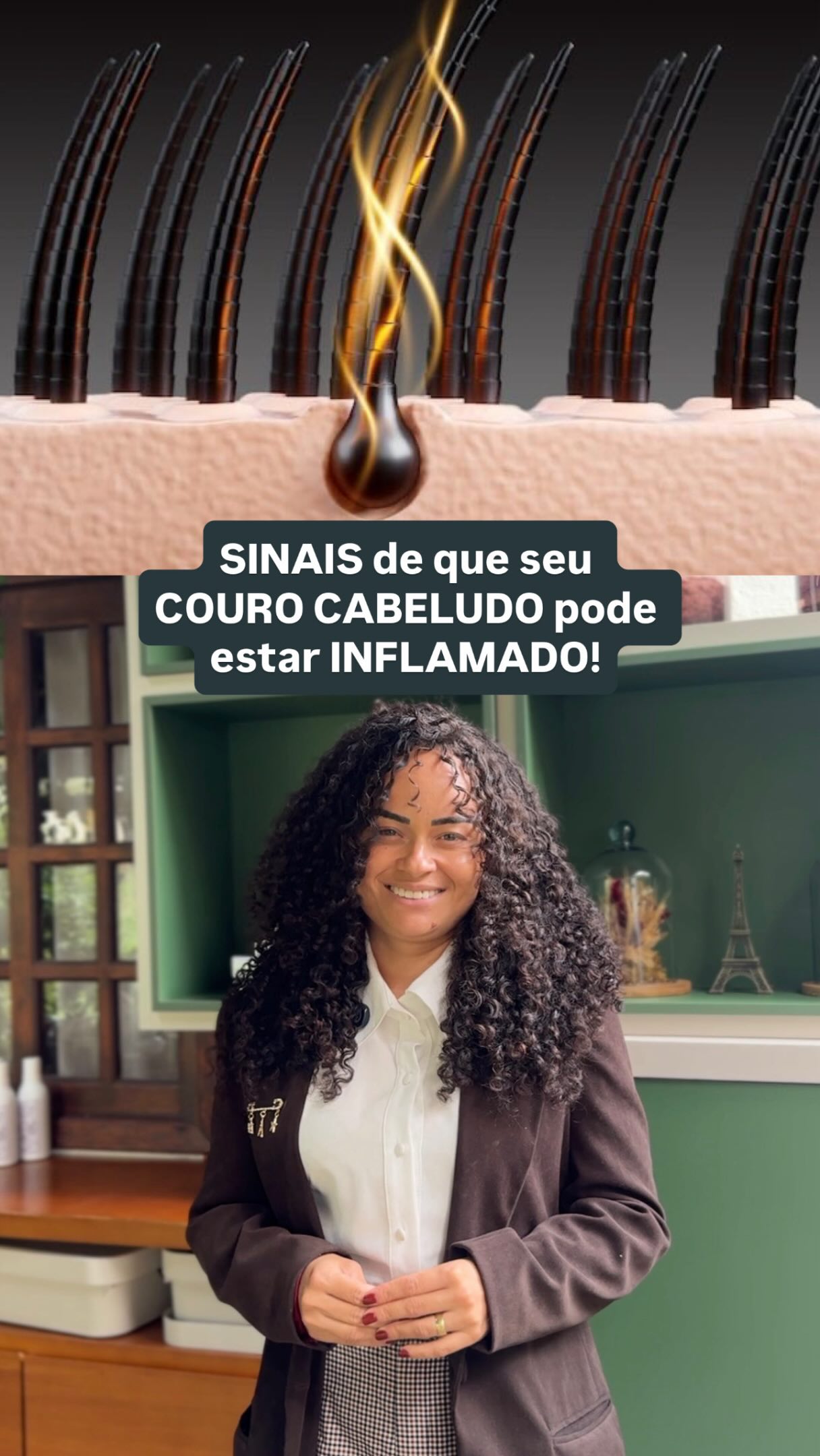 Seu couro cabeludo pode estar dando sinais de inflamação e v