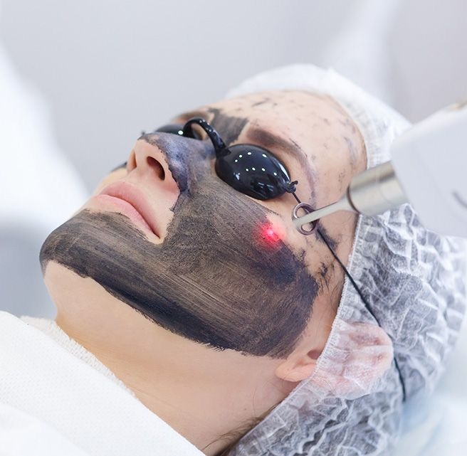 Laser Treatment 1