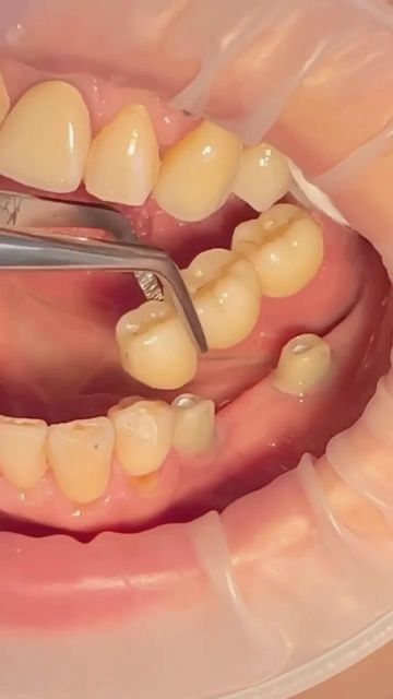 Dental Service 1