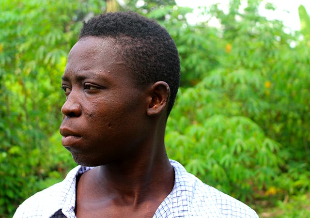 Leprosy Lives On In Nigeria 20 Years After Its Elimination As A Public Health Problem Devex