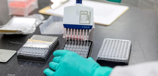 Opinion: Testing our way to a long-term strategy for HIV elimination