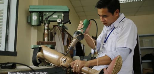 Opinion: How to ensure improved rehab services for the limb loss community