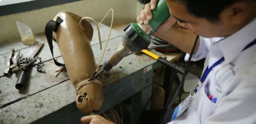 Opinion: 3 ways to support prosthetic development — and amputees