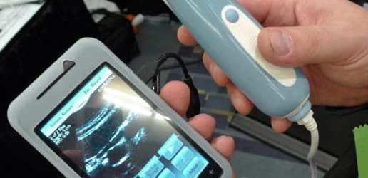 4 innovations on mHealth and POC devices