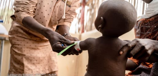 Opinion: We need innovation in the fight against child malnutrition